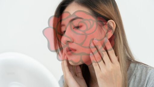 Kuperóza a rosacea je vážny problém. Aký je medzi nimi rozdiel a ako ich riešiť? Sú to dva rôzne stavy, ovplyvňujú pokožku tváre,